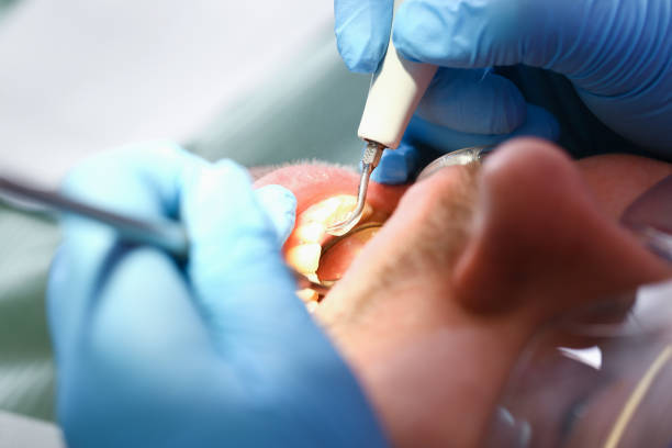 Best Urgent Care for Lost Fillings or Crowns in Gramercy, LA